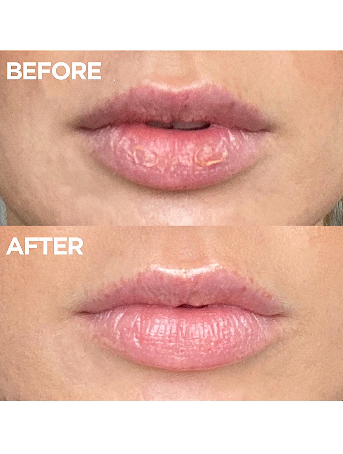 Before and after close up of lips showing the visible results of Lanolips 101 Ointment made with 100% ultra-pure grade lanolin. The top image displays dry, flaky lips, while the bottom shows visibly softer, smoother, and glossier lips, highlighting intense hydration and repair.